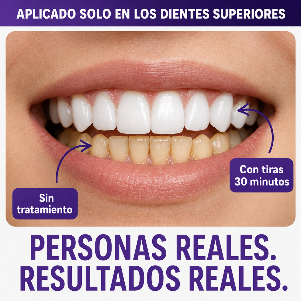LumaWhite™ | Tiras blanqueadoras ORIGINALES | Sonrisa Blanca Instantánea